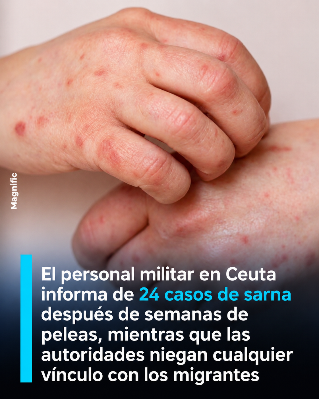 FBF59D64 92E1 4898 AC98 8839A6AD7E15